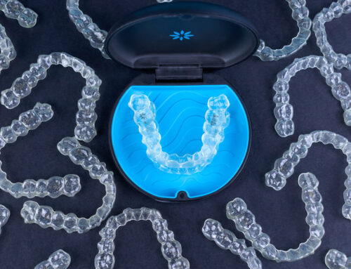 Invisalign FAQs – Answers to Your Common Questions