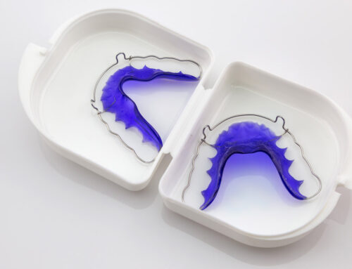 Understanding The Different Types of Orthodontic Retainers