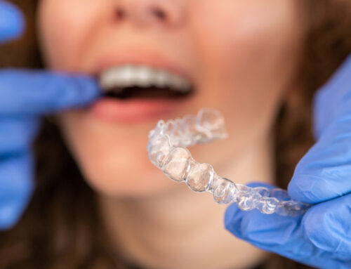 What Is Invisalign and How Does It Work?