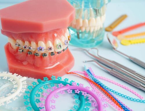 Orthodontic Treatments for Teens: What Parents Should Know